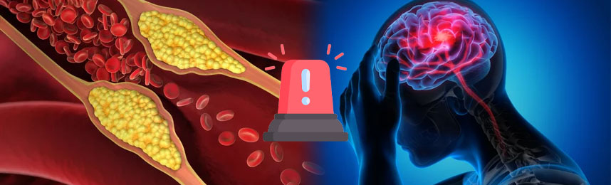 食後高血糖・血糖値スパイクのリスク